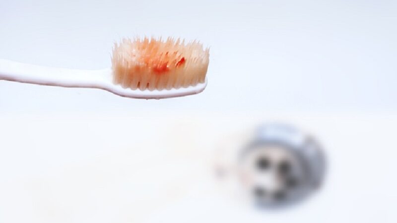 Preventing tooth decay and gum disease at your Coorparoo family dental practice