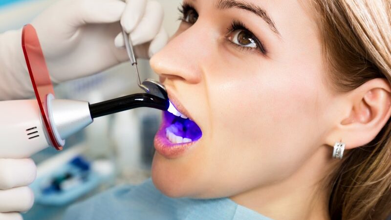 Restoring Your Smile with Dental Bonding