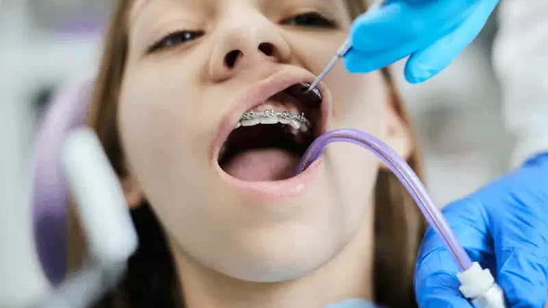 The Most Common Orthodontic Issues 