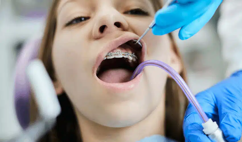 The Most Common Orthodontic Issues 