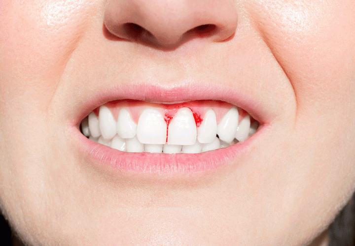 Healthy Smile, Healthy Life: Why Regular Dental Checkups Matter?