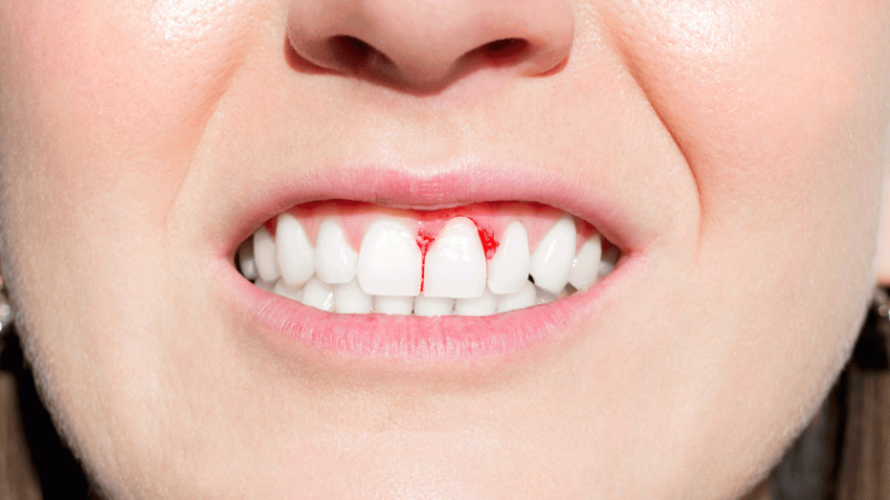 Healthy Smile, Healthy Life: Why Regular Dental Checkups Matter?