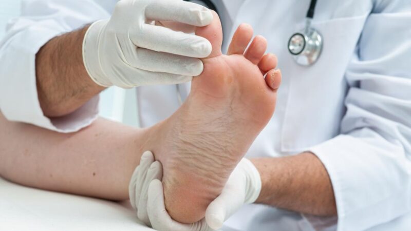The Common Foot Disorders Treated by a Podiatrist