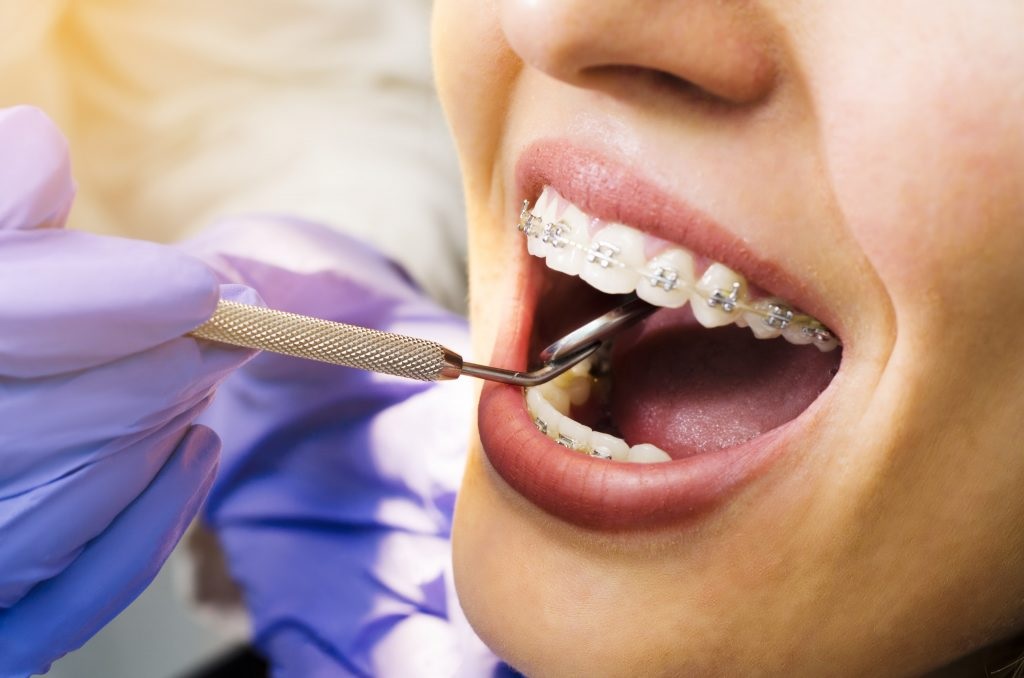 A Comprehensive Guide to the Stages of Orthodontic Treatment