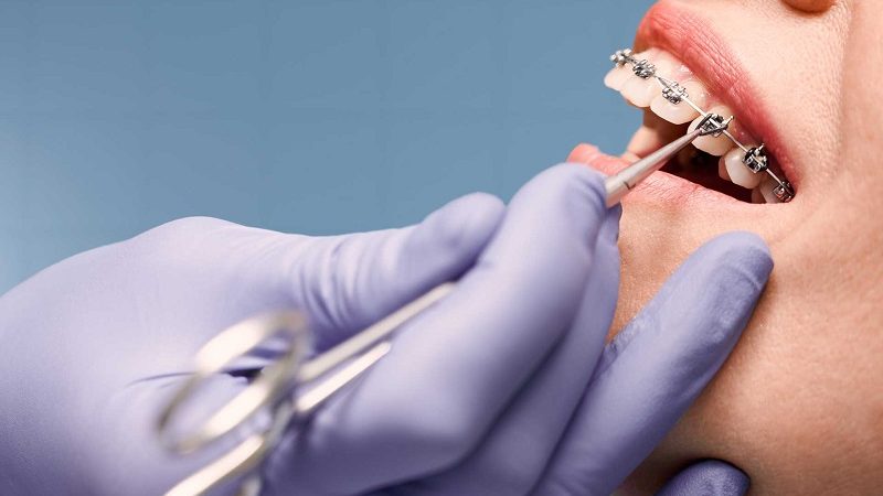 More than Just Looks: Making Dental Websites Accessible and Inclusive for All Patients
