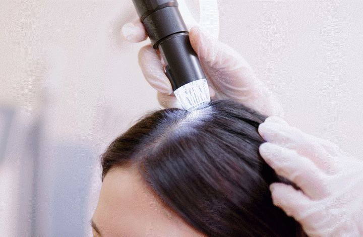 Pregnancy Hair Loss: Myths, Facts, and Practical Solutions