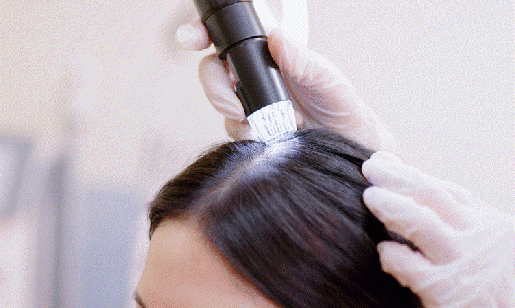 Pregnancy Hair Loss: Myths, Facts, and Practical Solutions