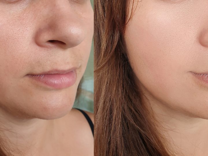 Trending Plastic Surgery Procedures in Singapore