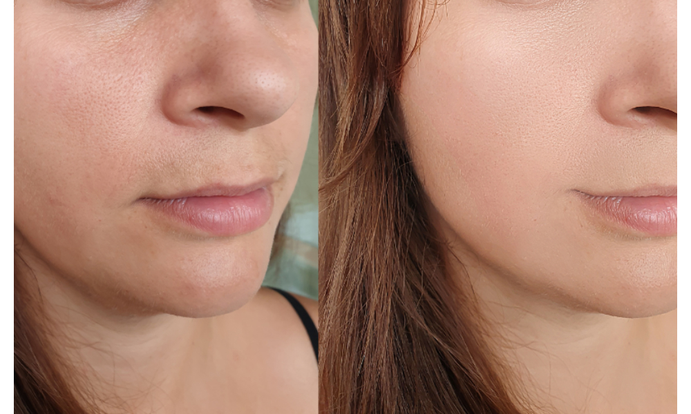 Trending Plastic Surgery Procedures in Singapore