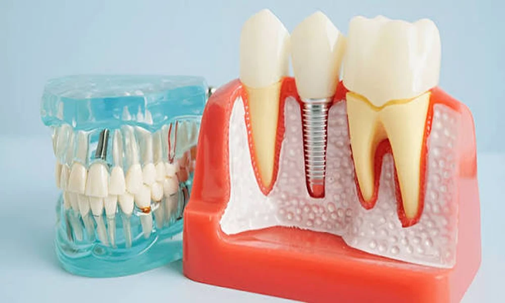Dental Solutions Designed for Stronger Teeth and Lasting Everyday Confidence