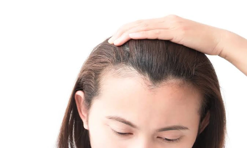 How Restoring More Than Just A Receding Hairline Is Possible With Hair Transplants